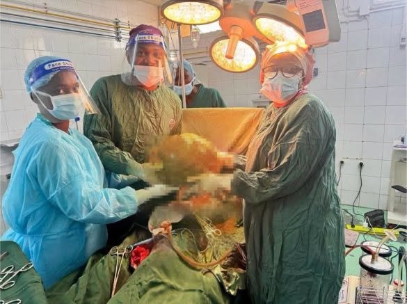 HOSPITAL CENTRAL DE NAMPULA REMOVE MASSA ABDOMINAL DE 20 QUILOS A MULHER DE 65 ANOS